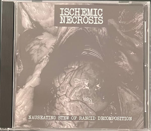 Ischemic Necrosis – Nauseating Stew Of Rancid Decomposition — фото товара