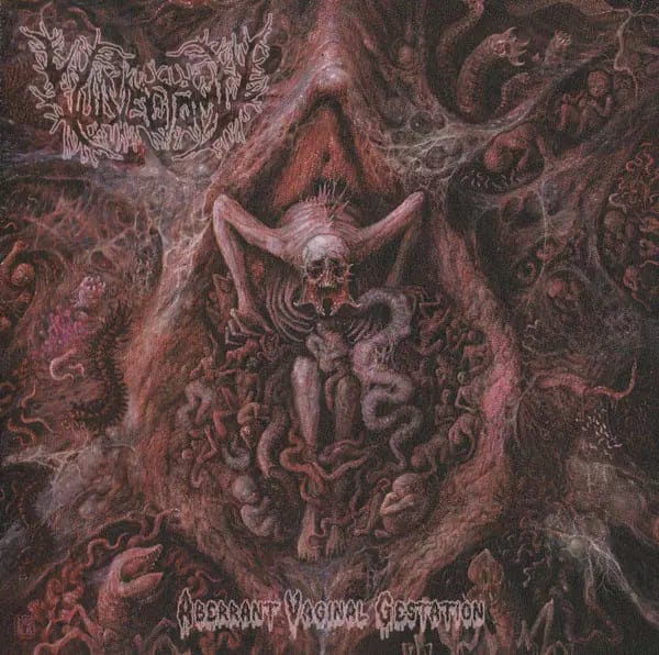 Vulvectomy – Aberrant Vaginal Gestation CD jewel case — фото товара